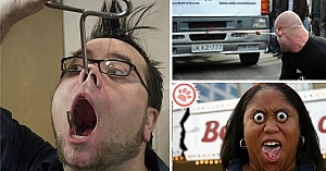 10 People Who Are A Living Proof That Human Body Has No Limits