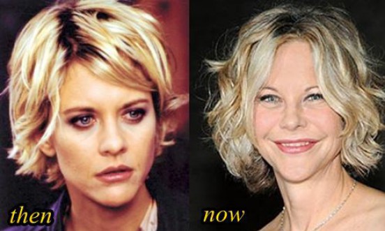 Meg Ryan