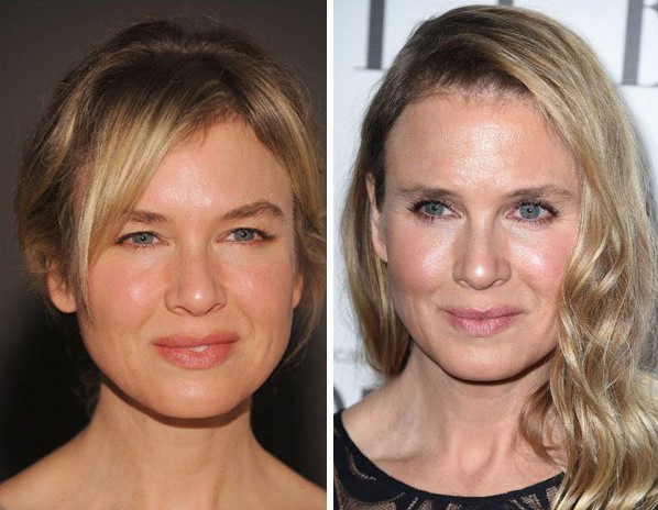 Renee Zellweger 