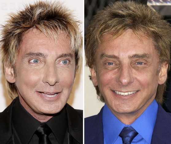 Barry Manilow