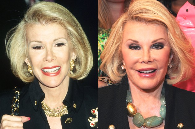 Joan Rivers