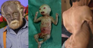 The Most Bizarre Medical Conditions That You Have Never Heard Of Before