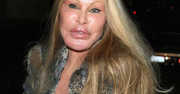 #6 Jocelyn Wildenstein