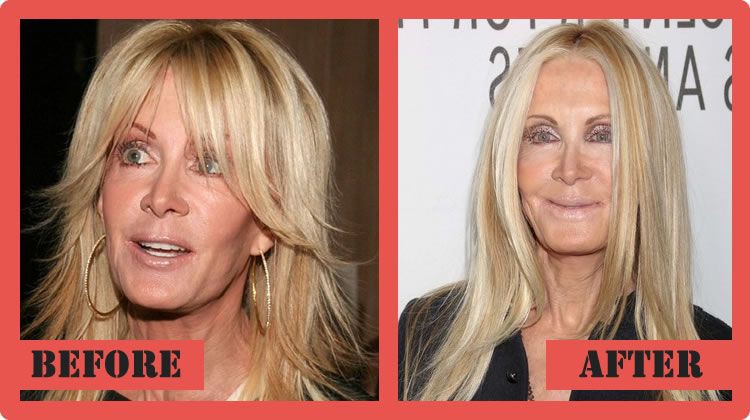 #14 Joan Van Ark