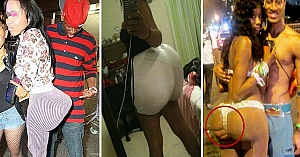 These Ladies Have No Limits When It Comes To Butt Implants