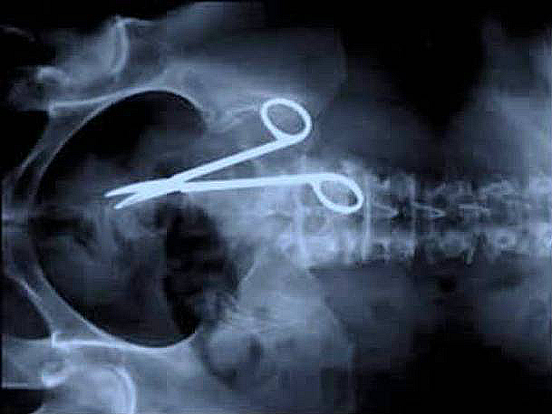Surgical scissors