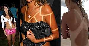 10 Tan Lines No One Wish To Get This Summer
