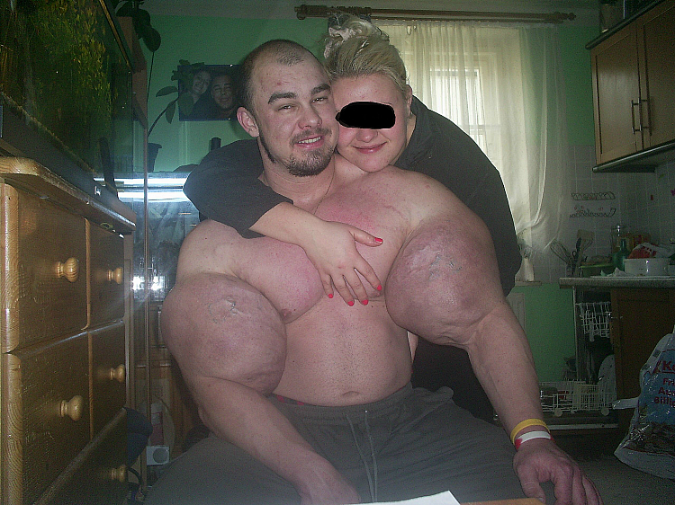 #2